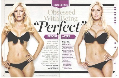 heidi montag before and after plastic surgery 2010. I#39;ve had jaw surgery – it