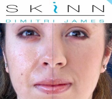 skinn_ba skinn_ba