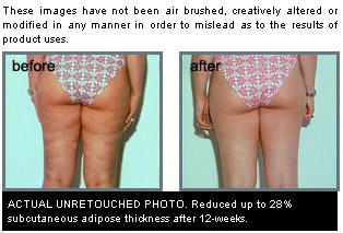 before_after before_after