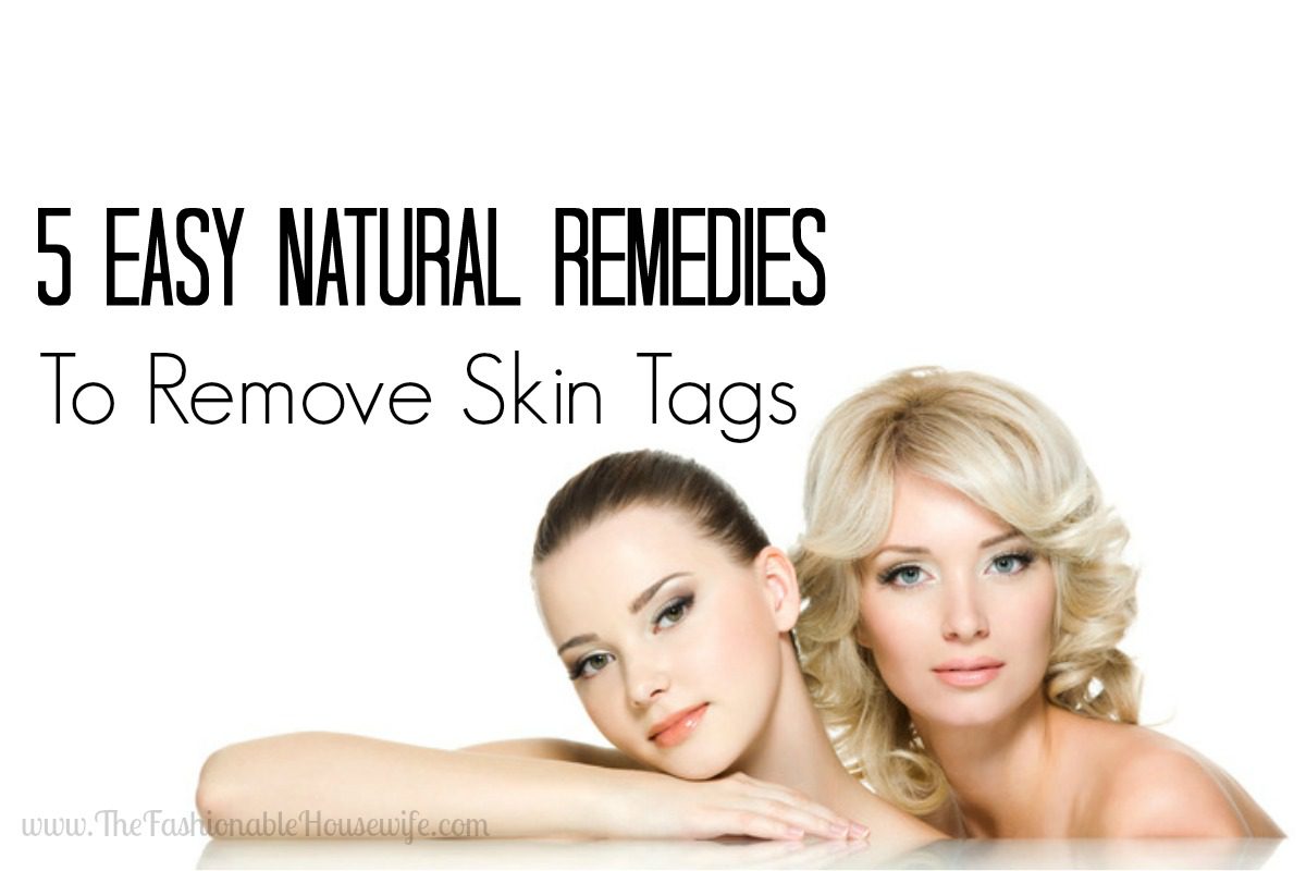 5 Easy Natural Remedies to Remove Skin Tags