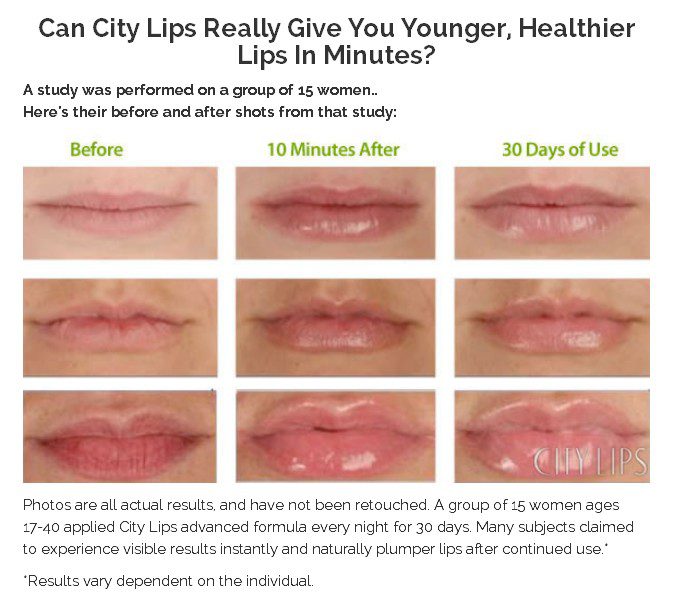 city lips