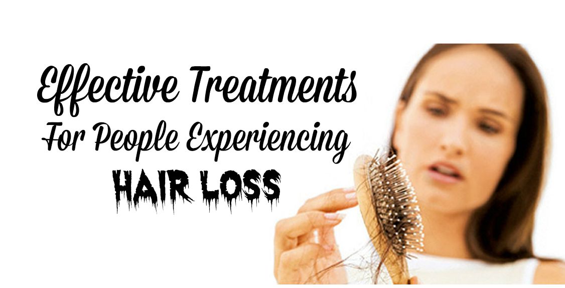 Effective Treatments For People Experiencing Hair Loss