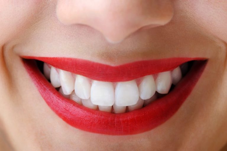 Post-Whitening Wisdoms: Tips to Keep Your Teeth Bright