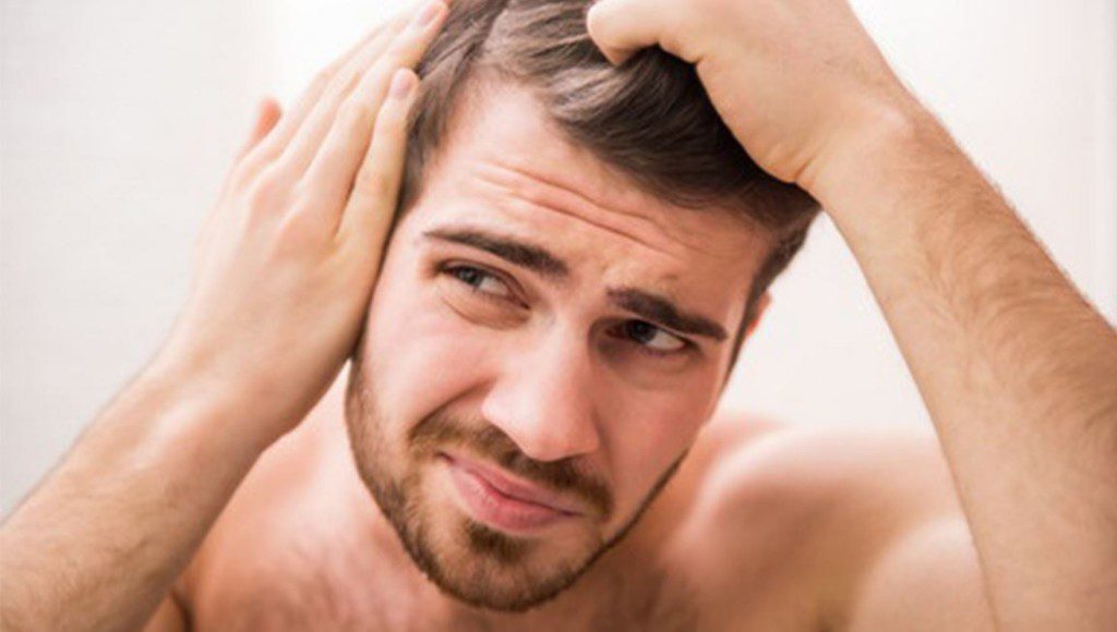 Fashionable Husbands: How to Fight Male Pattern Baldness