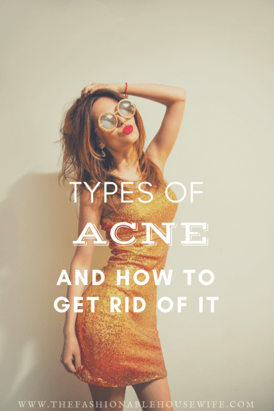 Types of Acne And How To Get Rid Of It