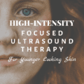 High-Intensity Focused Ultrasound Therapy for Younger Looking Skin