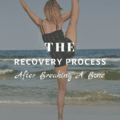 The Recovery Process After Breaking A Bone