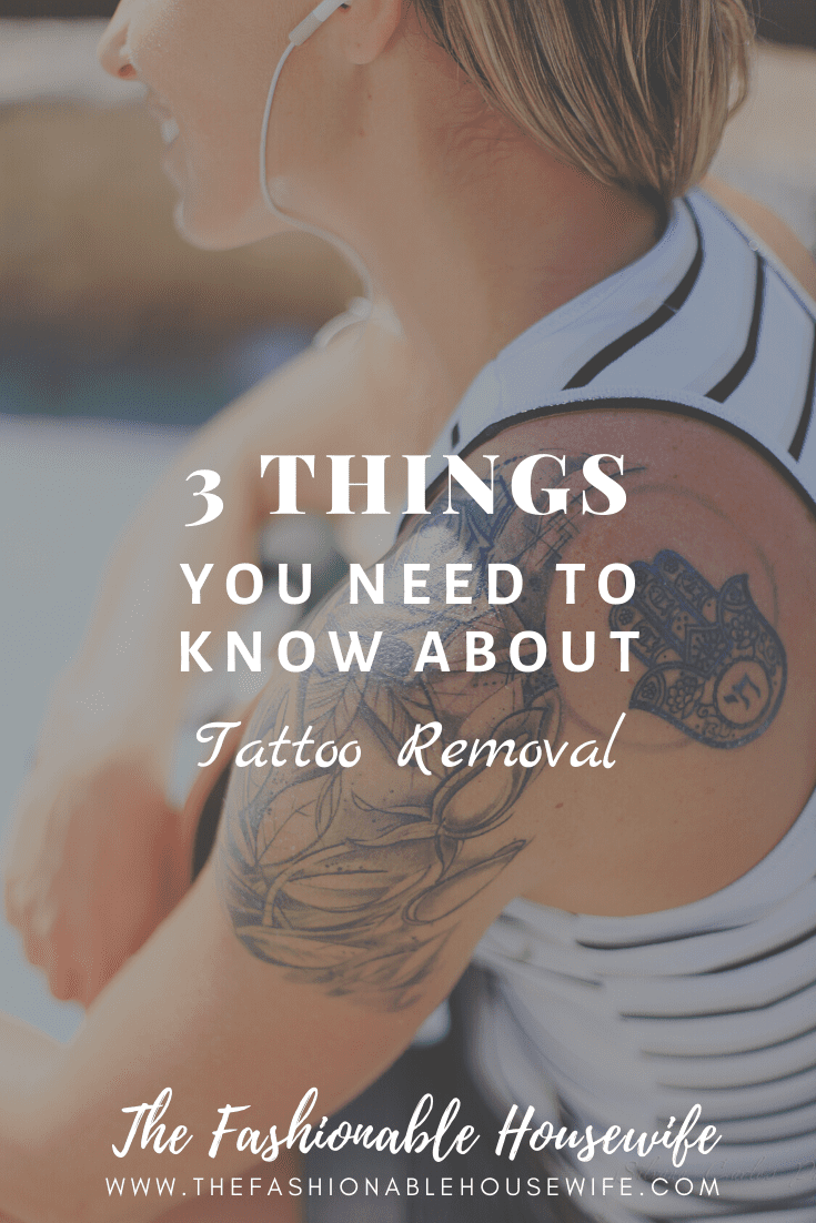 3 Things You Need To Know About Tattoo Removal