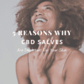 5 Reasons Why CBD Salves Are Important For Your Skin