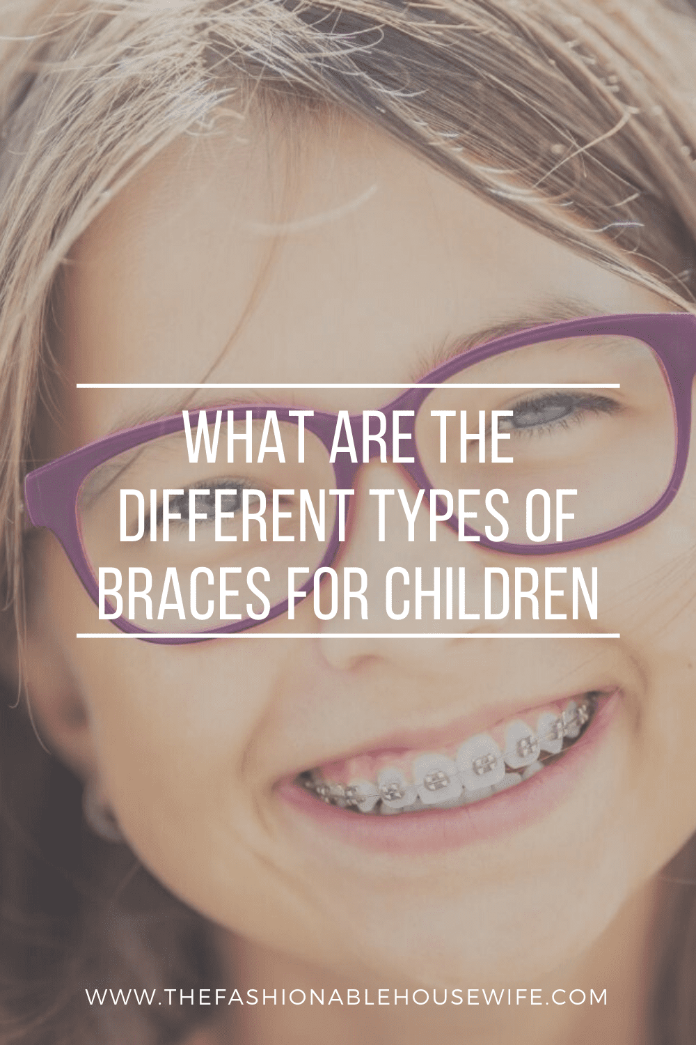 What Are The Different Types of Braces For Children