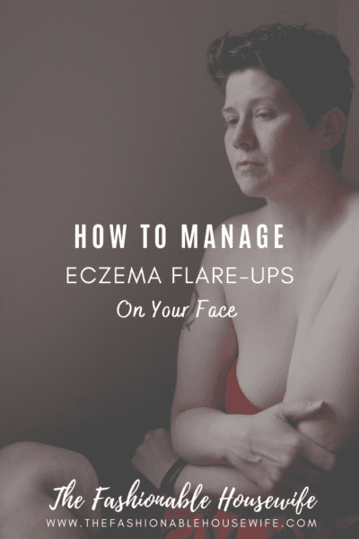How to Manage Eczema Flare-Up on Your Face