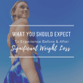 What You Should Expect To Experience Before And After Significant Weight Loss