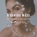 6 Genius Ways To Tackle Oily Skin, The Natural Way