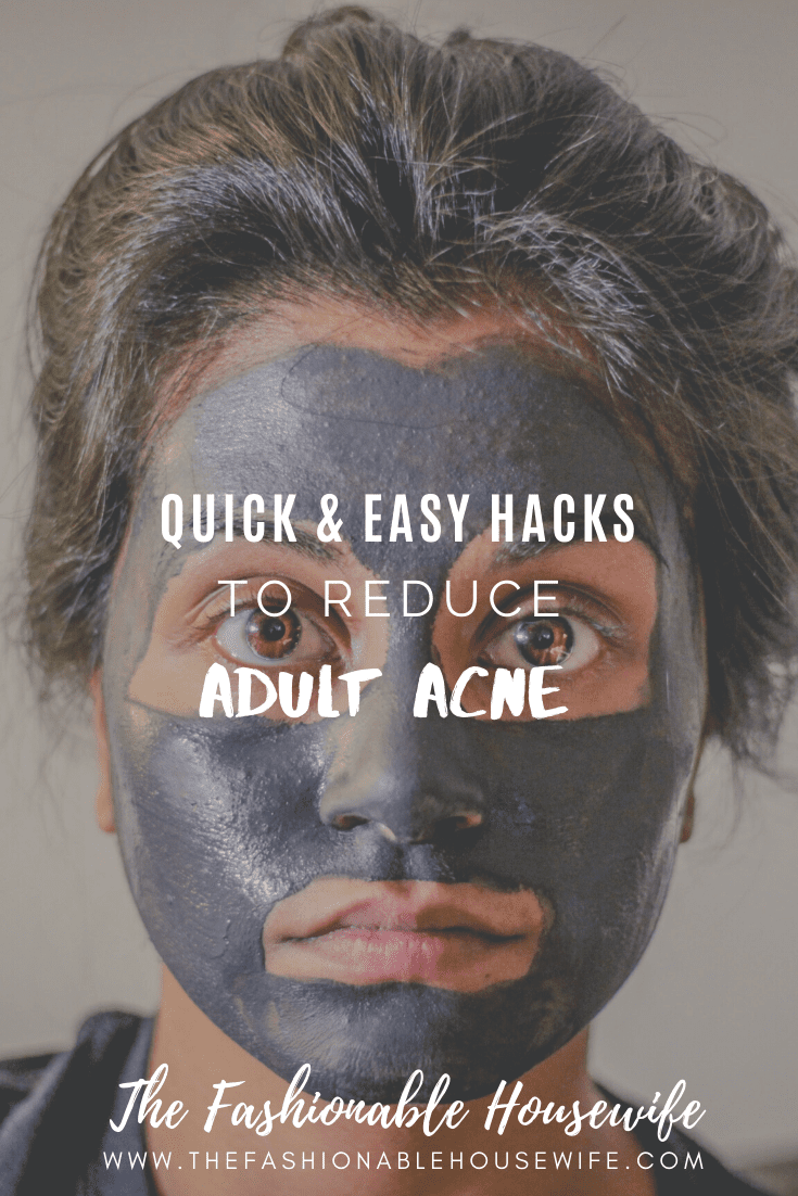 Quick & Easy Hacks To Reduce Adult Acne