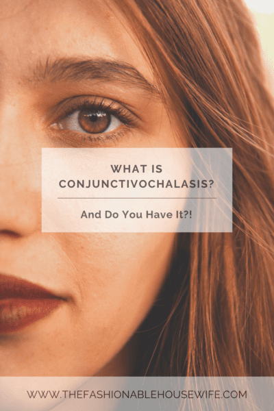 What is Conjunctivochalasis? And Do You Have It?!