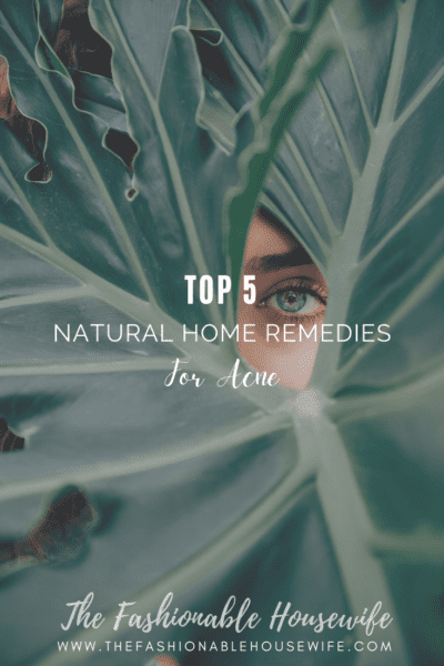 Top 5 Natural Home Remedies for Acne
