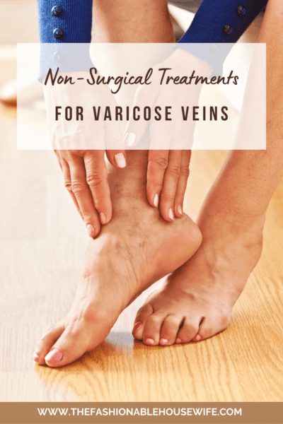 Non-Surgical Treatments For Varicose Veins: What To Expect & How To Get Started