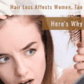 Not Just Men: Hair Loss Affects Women, Too - Here's Why