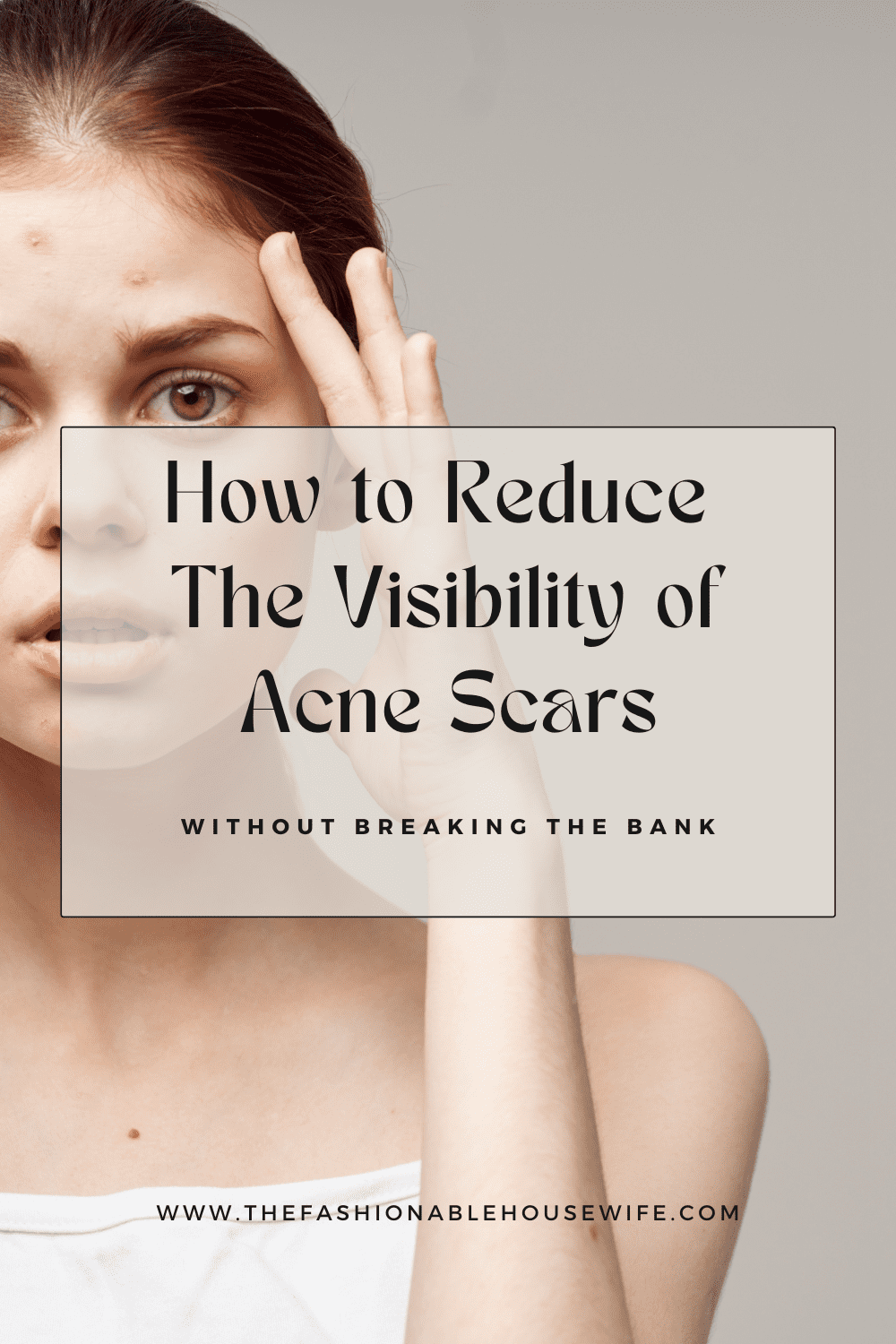 How to Reduce the Visibility of Acne Scars