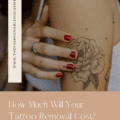 How Much Will Your Tattoo Removal Cost?