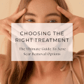Choosing The Right Treatment: The Ultimate Guide To Acne Scar Removal Options