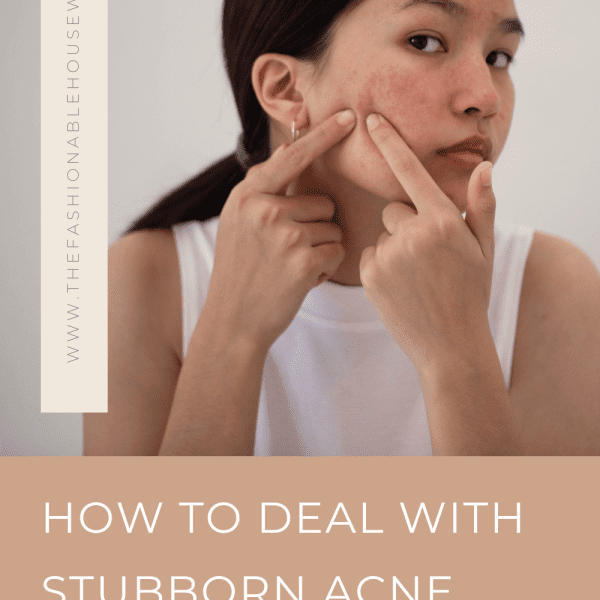 How To Deal With Stubborn Acne