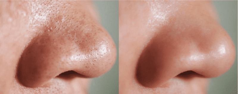 double cleansing 101