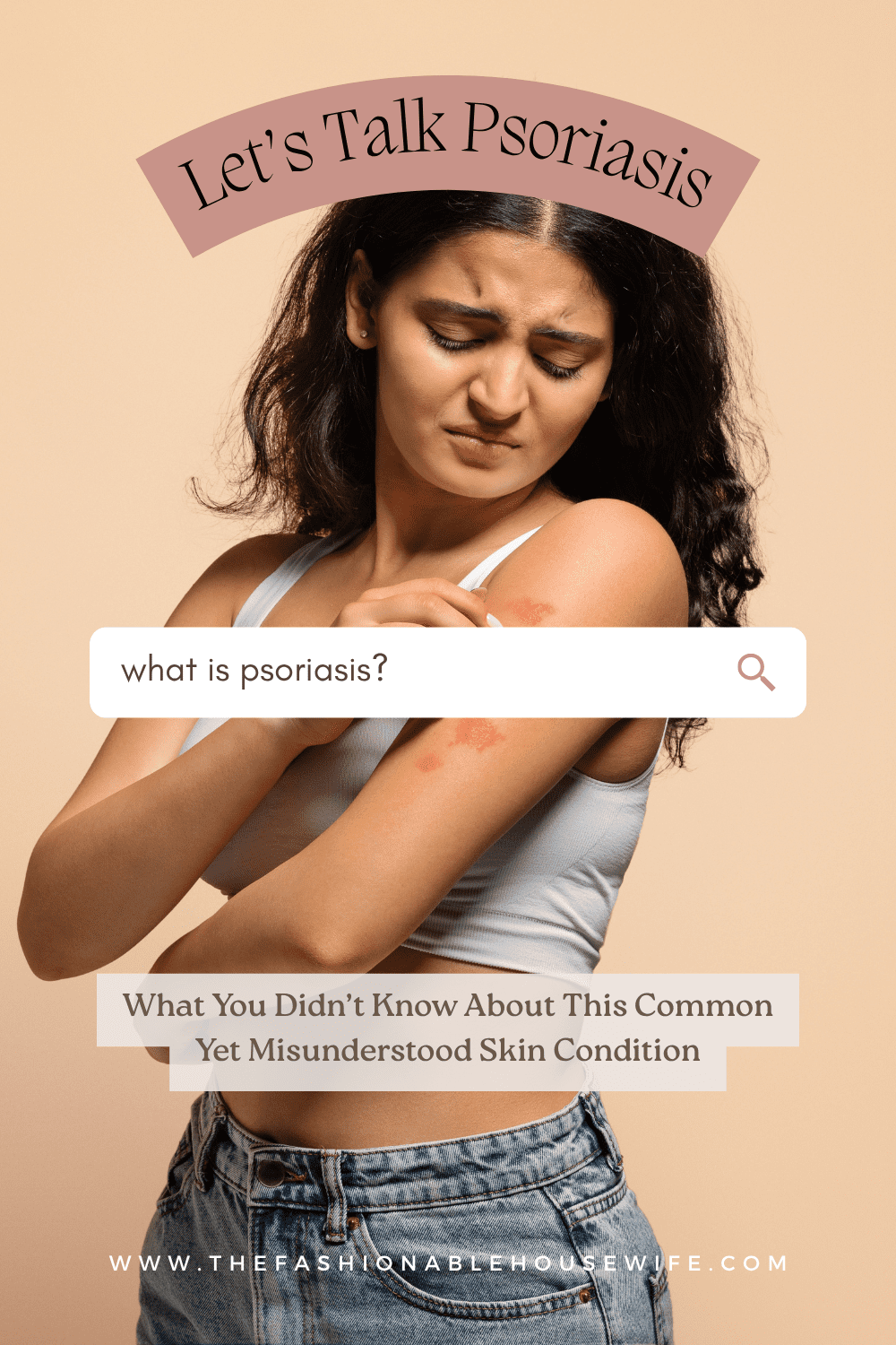 Let’s Talk Psoriasis: What You Didn’t Know About This Common Yet Misunderstood Skin Condition
