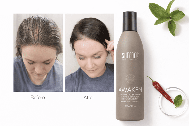 surface hair awaken kit